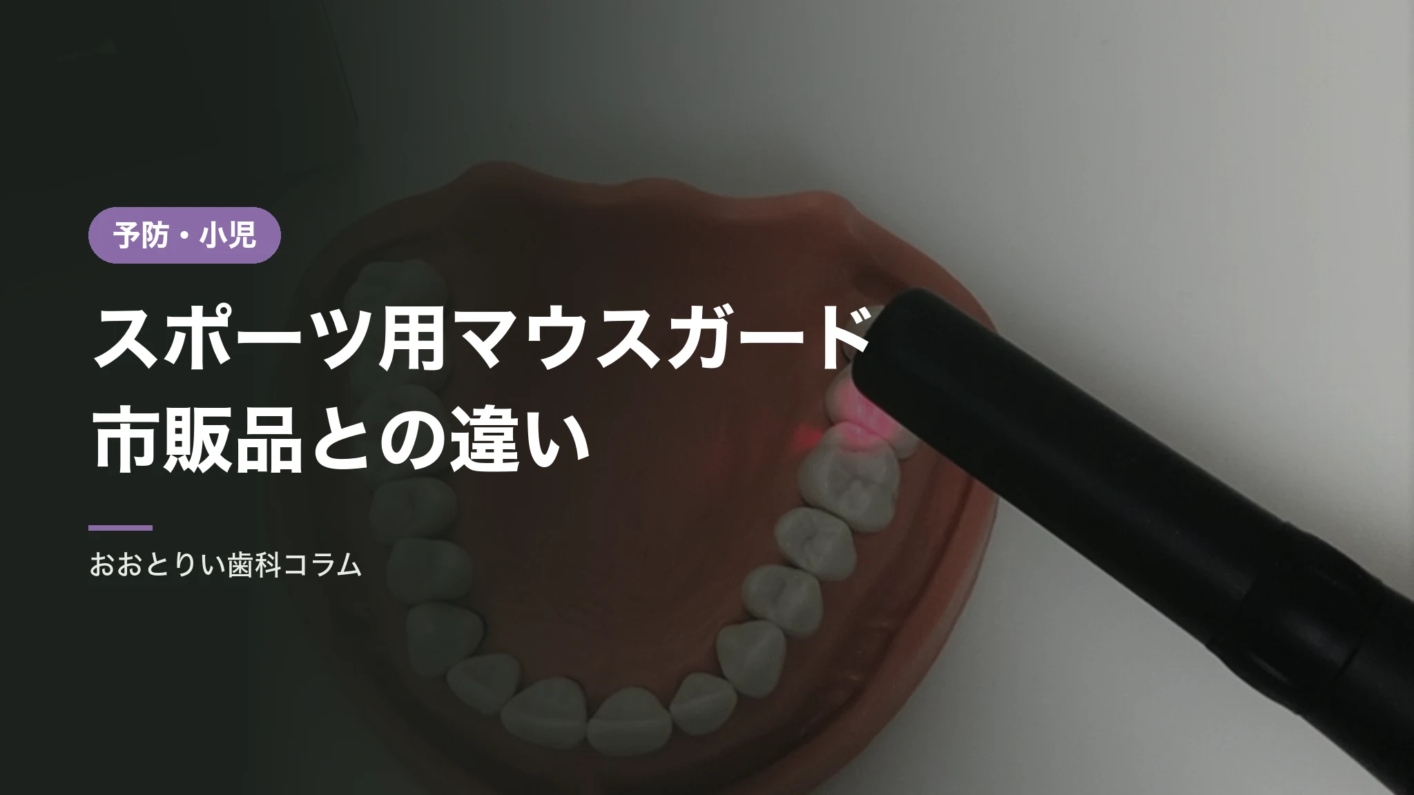 スポーツ用マウスガードの効果と作り方｜市販品との違い
